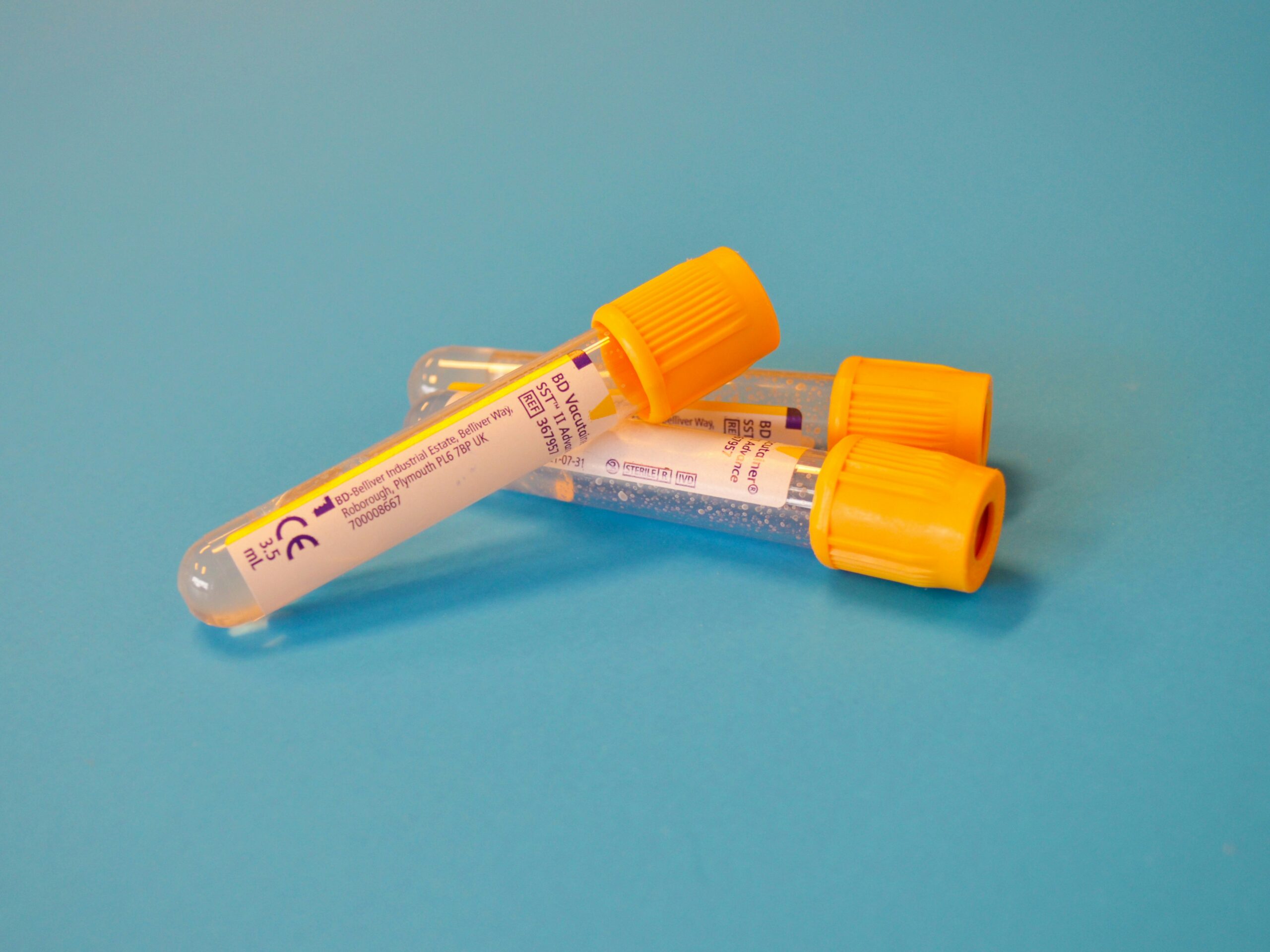 test results blood vials what do blood work results mean