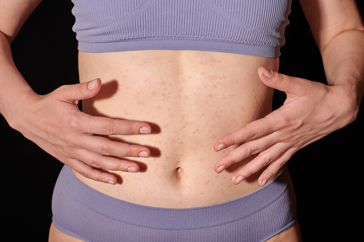 inflammation cycle syncing woman touching her stomach gut skin connection