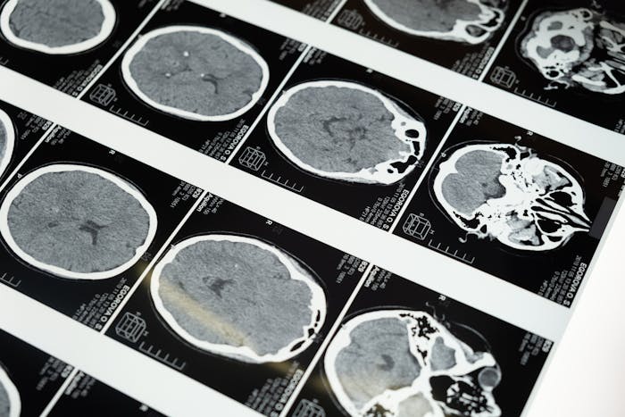 elder brain featured image