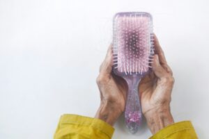 hairbrush hair loss -supplements for hair loss